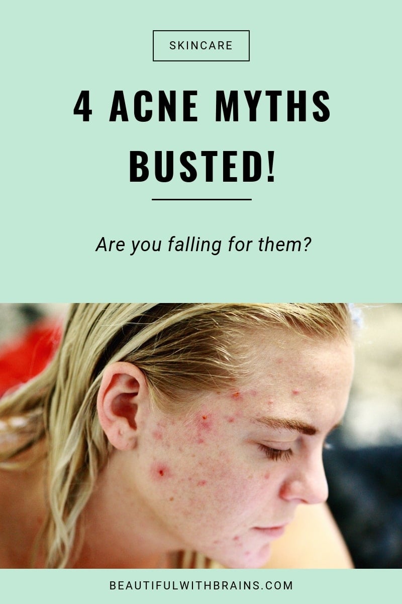 4 acne myths