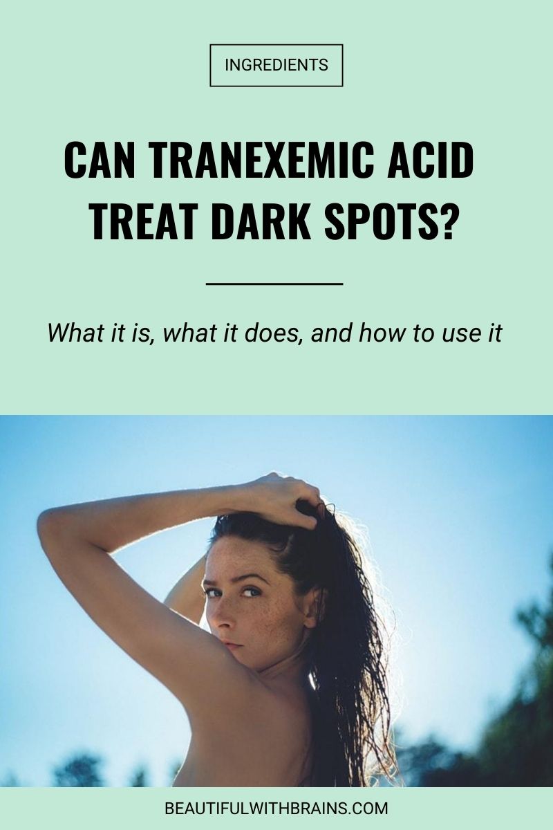 Can Tranexemic Acid treat dark spots